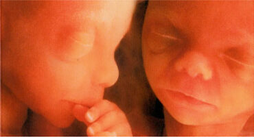 „Er-Lösung“ – Heilungswege für alleingeborene Zwillinge